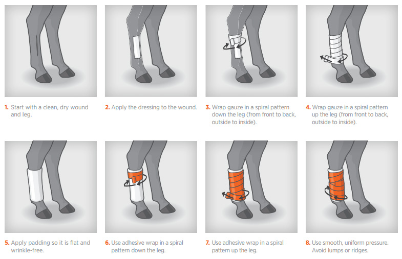 Emergency Care for Leg Wounds Emergency Care for Leg Wounds